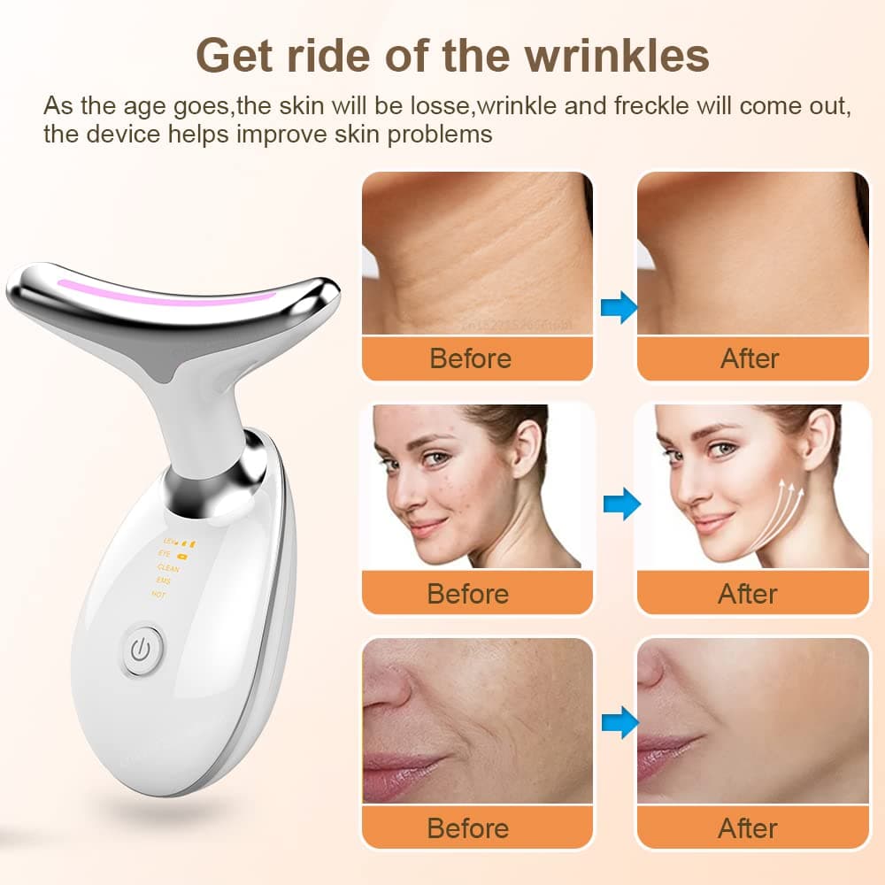 IPL Winkel Reducing Device (7 Colour Led Light Therapy) - alt